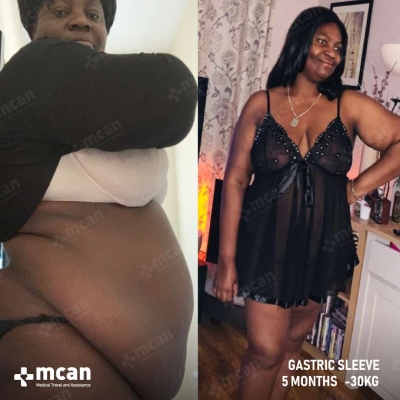 Actual MCAN Health patient before and after Treatment
