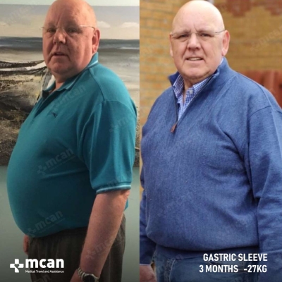 Actual MCAN Health patient before and after Treatment