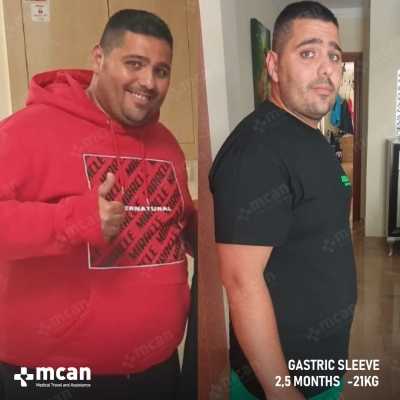 Actual MCAN Health patient before and after Treatment