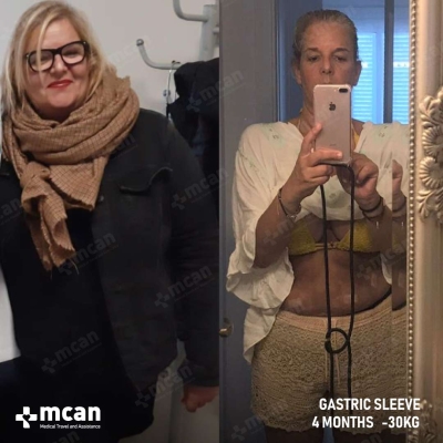 Actual MCAN Health patient before and after Treatment