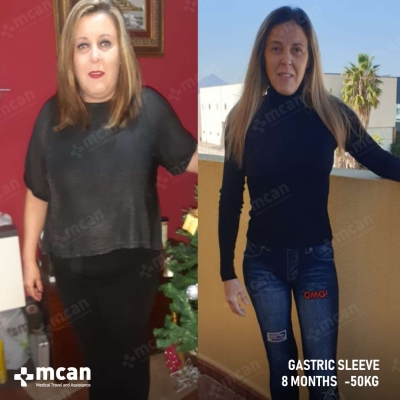 Actual MCAN Health patient before and after Treatment