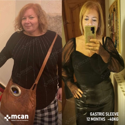 Actual MCAN Health patient before and after Treatment