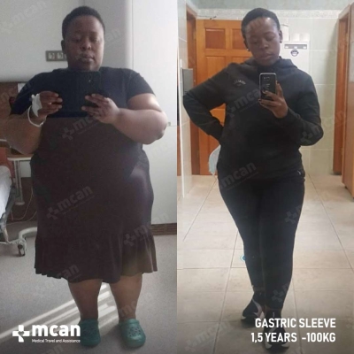 Actual MCAN Health patient before and after Treatment