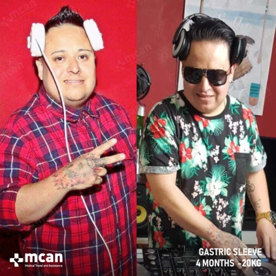 Actual MCAN Health patient before and after Treatment