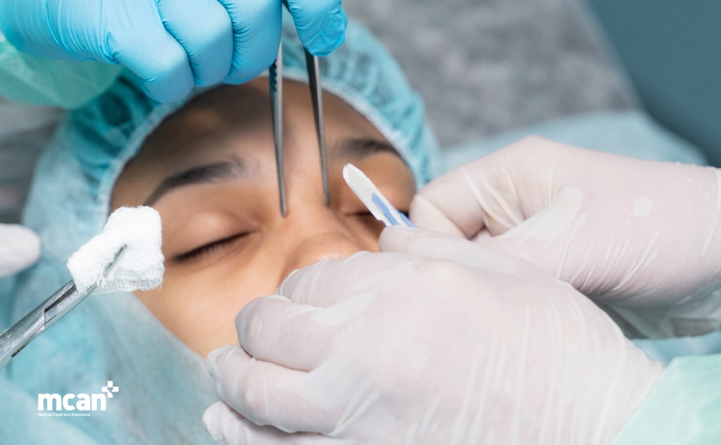 When Rhinoplasty May Not Be the Right Step Yet