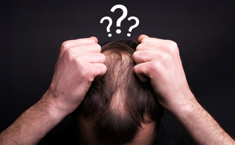 Tipos de Alopecia: ¿Cuáles Son y Cómo Tratarlas? 9 Types of Alopecia 1 un blog sobre tipos de alopecia