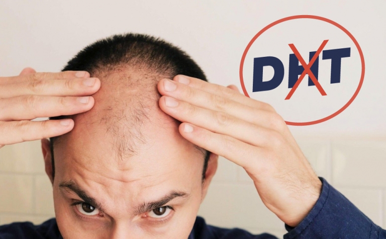Everything You Should Know About DHT Blockers | MCAN Health Blog