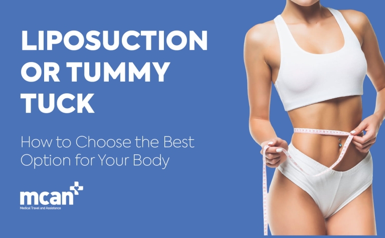 Liposuction or Tummy Tuck en