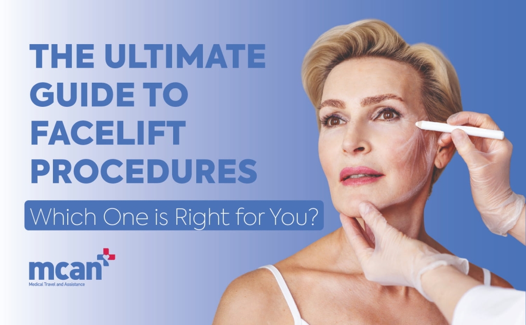 The Ultimate Guide to Facelift Procedures: Which One is Right for You? 1 Ultimate Guide to Facelift Procedures EN Ultimate Guide to Facelift Procedures EN