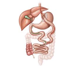 Gastric Sleeve Surgery