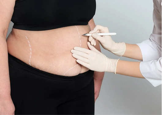 Weight Loss Surgery Medical Consultation