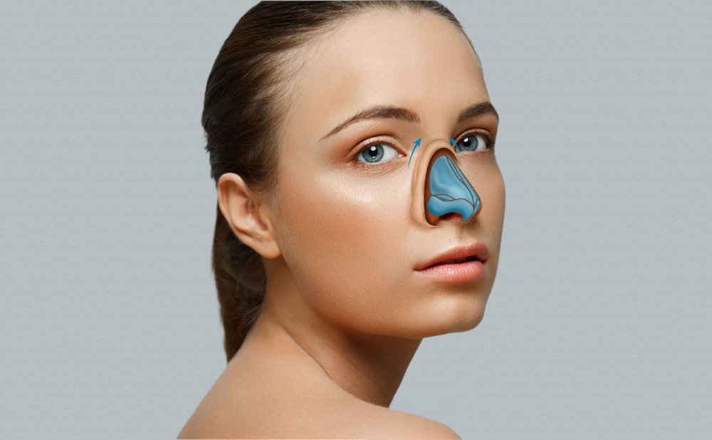 What Is Thick Skin Rhinoplasty