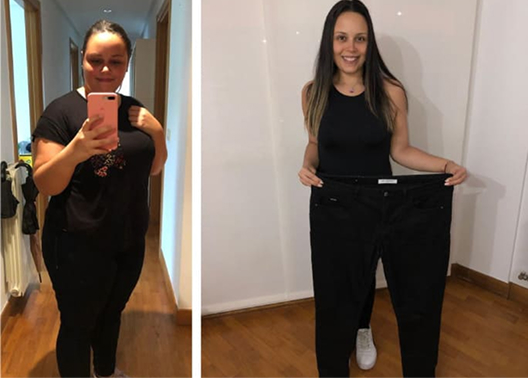 What is Weight Loss Surgery