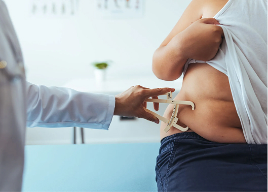 Why Should You Get Weight Loss Surgery in Turkey 1