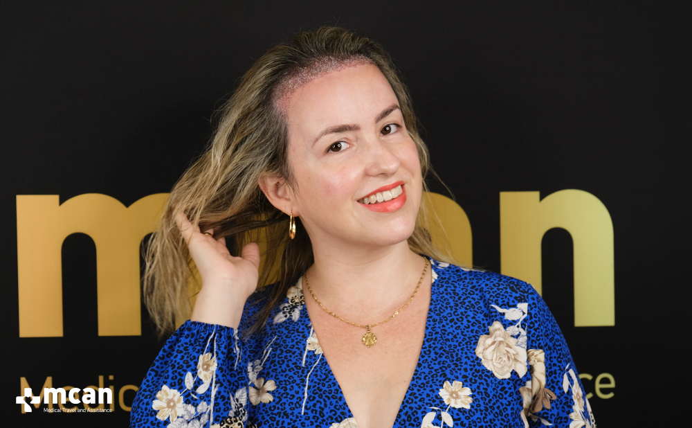 Female Hair Transplant: Everything You Need to Know Before Treatment 3 Do I Need to Shave My Head for a Female Hair Transplant Do I Need to Shave My Head for a Female Hair Transplant