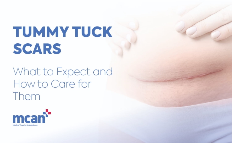 Tummy Tuck Scars: What to Expect and How to Care for Them 7 Tummy Tuck Scars EN Tummy Tuck Scars EN