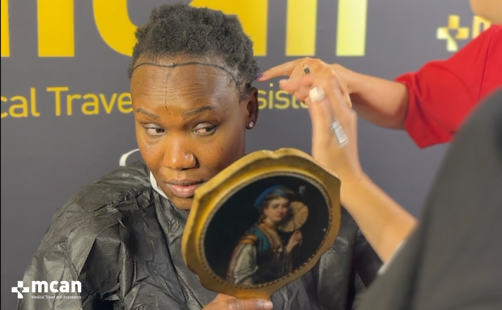 Female Hair Transplant: Everything You Need to Know Before Treatment 2 Why Does Female Hair Loss Happen Why Does Female Hair Loss Happen