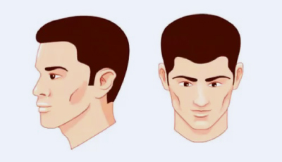 stage1