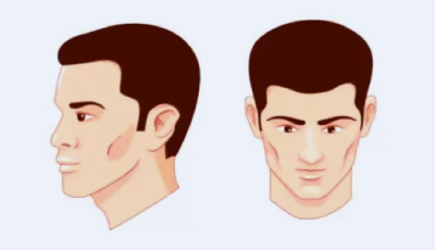 stage2