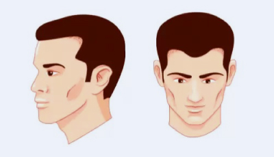 stage3