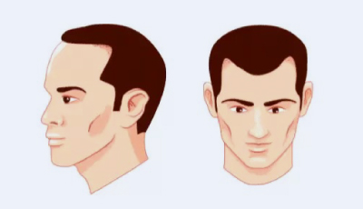 stage4