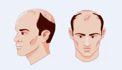 stage7