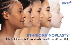 Ethnic Rhinoplasty Cover