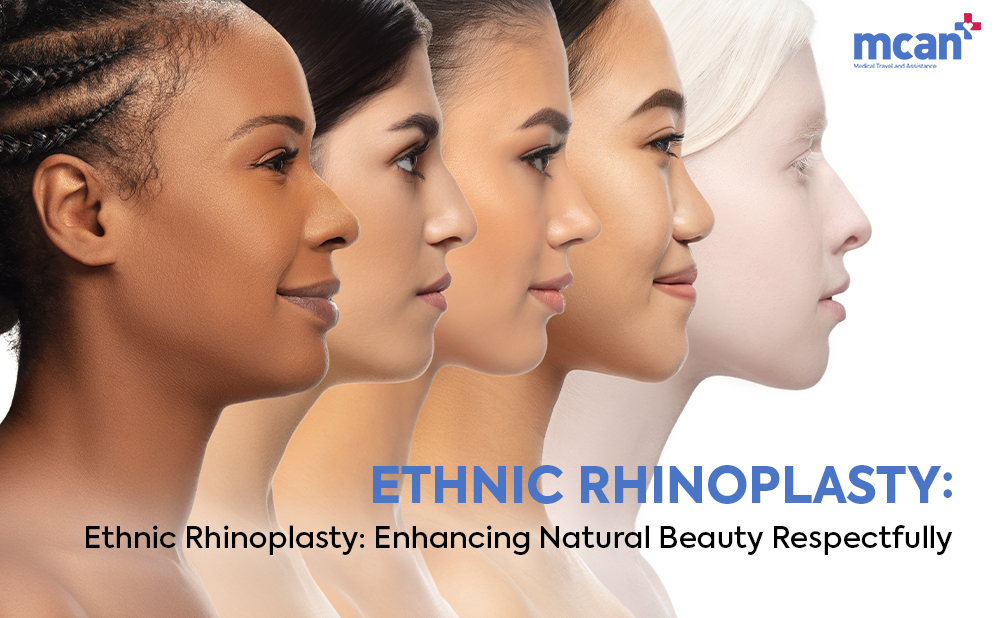 Ethnic Rhinoplasty: Enhancing Natural Beauty Respectfully 1 Ethnic Rhinoplasty Cover Ethnic Rhinoplasty Cover