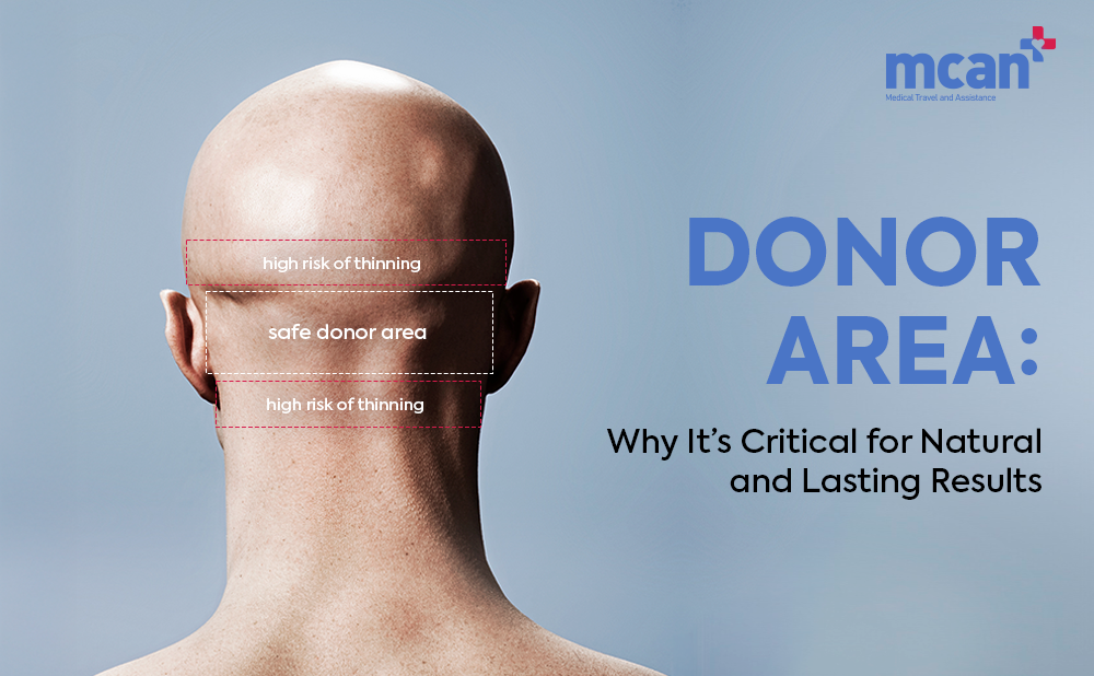 Hair Transplant Donor Area Cover 1