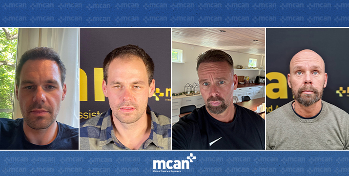 Why is Hair Transplant Cheap in Turkey 1 1