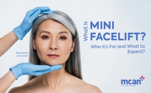 What is Mini Facelift Cover