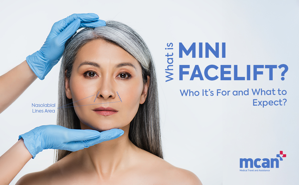 What Is a Mini Facelift? Who It’s For and What to Expect 1 What is Mini Facelift Cover What is Mini Facelift Cover