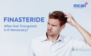 Finasteride After Hair Transplant Is It Necessary cover