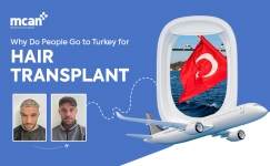 cover Why Do People Go to Turkey for Hair Transplant cover