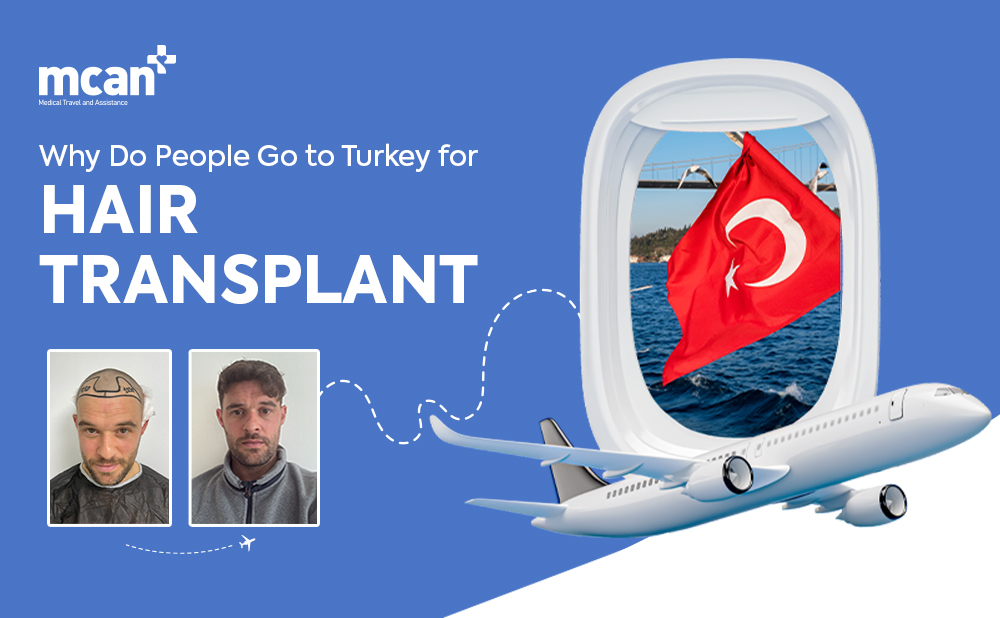 Why Do People Go to Turkey for Hair Transplant? 1 cover Why Do People Go to Turkey for Hair Transplant cover cover Why Do People Go to Turkey for Hair Transplant cover