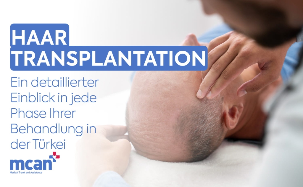 Haartransplantation: Phasen Ihrer Operation in der Türkei 1 DE HAIR TRANSPLANT OPERATION DE HAIR TRANSPLANT OPERATION