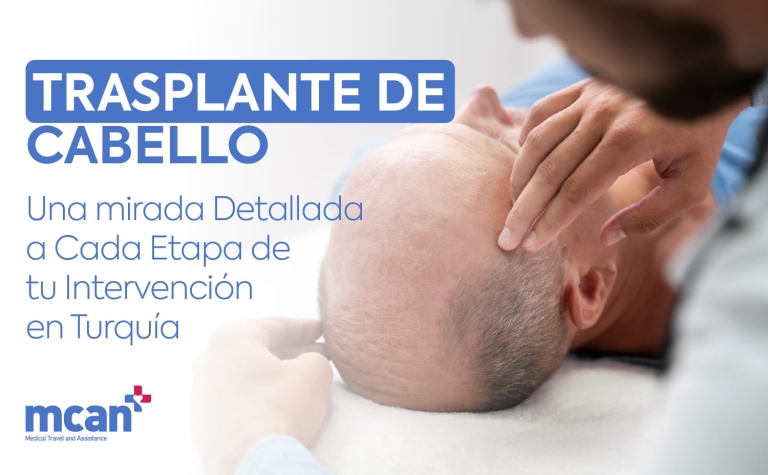 Operación de injerto capilar: todas las etapas de la cirugía en Turquía 5 ES HAIR TRANSPLANT OPERATION ES HAIR TRANSPLANT OPERATION