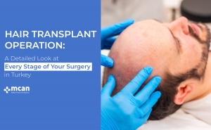 Hair Transplant Operation: A Detailed Look at Every Stage of Your Surgery in Turkey 4 Hair Transplant Operation Cover Hair Transplant Operation Cover