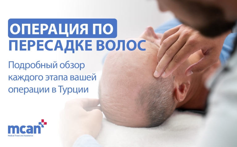 RU HAIR TRANSPLANT OPERATION
