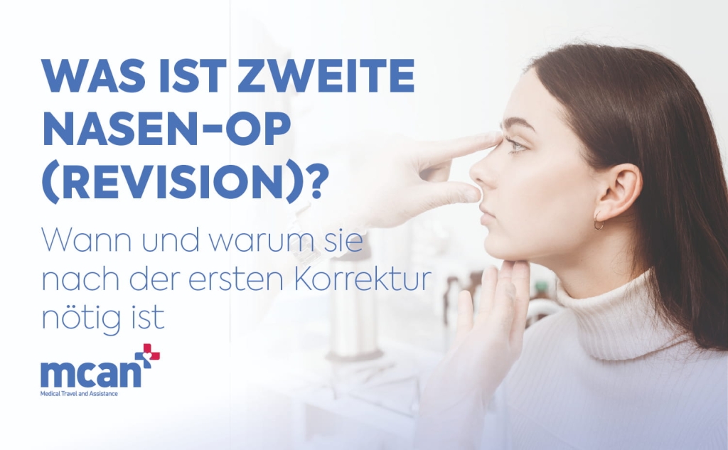 Revision Nasen OP: Alles über die zweite Nasenkorrektur 1 Revision Rhinoplasty de Revision Rhinoplasty de