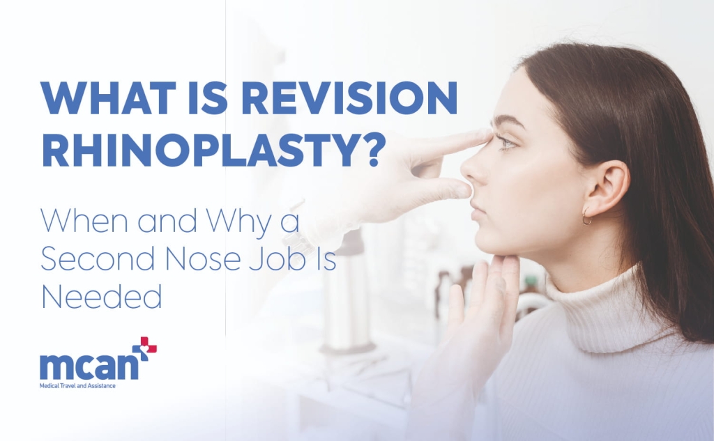 What Is Revision Rhinoplasty? When and Why a Second Nose Job Is Needed 1 Revision Rhinoplasty en Revision Rhinoplasty en