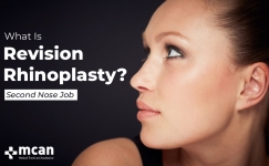 What is Revision Rhinoplasty cover 1
