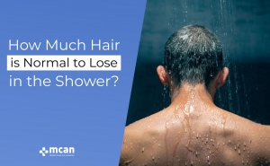 How Much Hair is Normal to Lose in the Shower? 3 Blog Cover Blog Cover