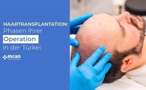 Haartransplantation: Phasen Ihrer Operation in der Türkei 2 Haartransplantation Phasen Ihrer Operation in der Turkei Haartransplantation Phasen Ihrer Operation in der Turkei