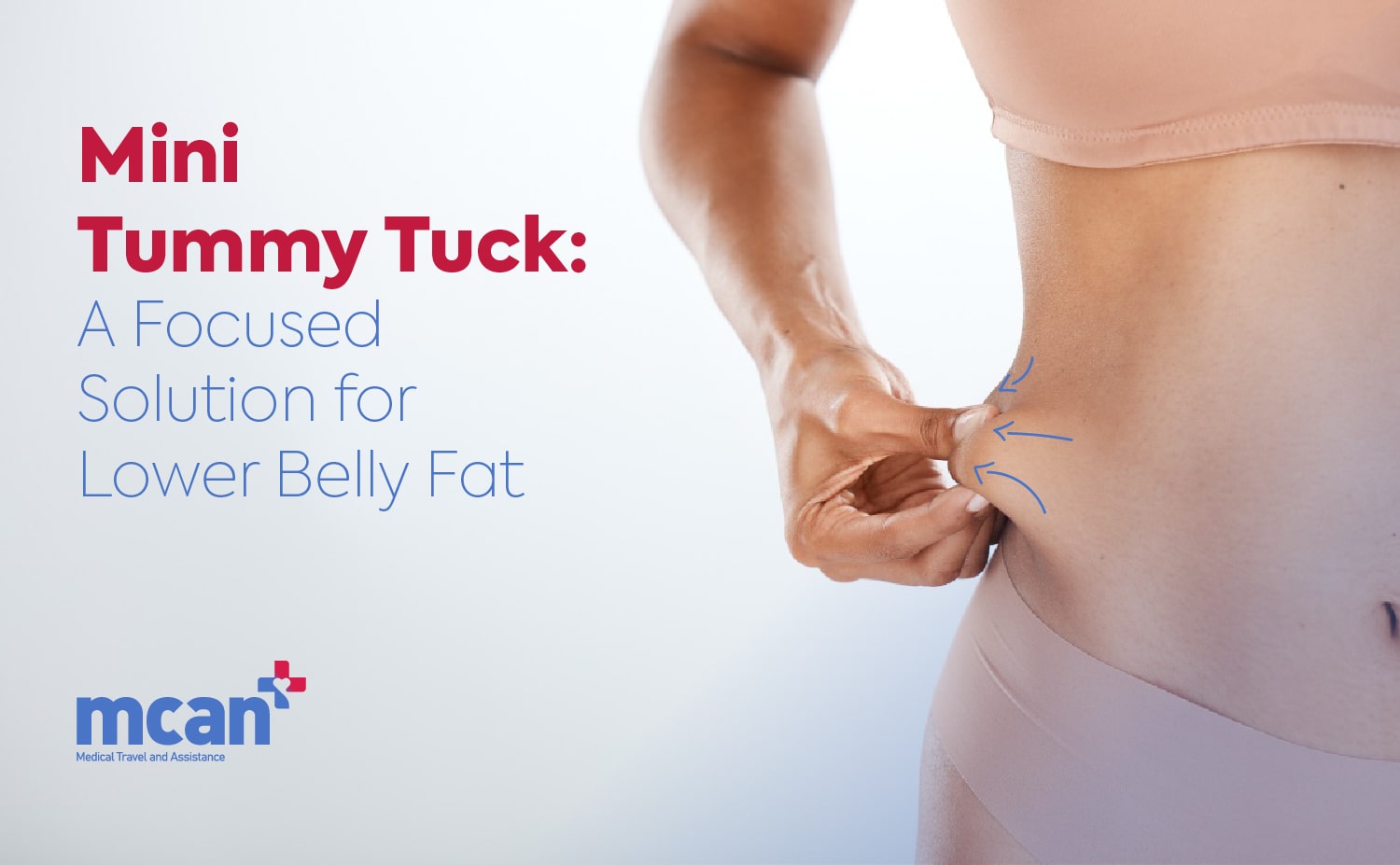 Mini Tummy Tuck: A Focused Solution for Lower Belly Fat 3 Mini Tummy Tuck Blog Cover min Mini Tummy Tuck Blog Cover min