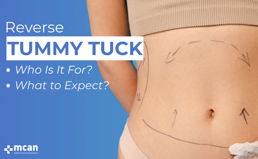 Reverse Tummy Tuck Blog Cover