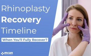 Rhinoplasty Recovery Timeline Blog Cover 2 1