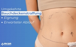 Umgekehrte Bauchdeckenstraffung