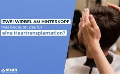 Was bedeutet das fur eine Haartransplantation