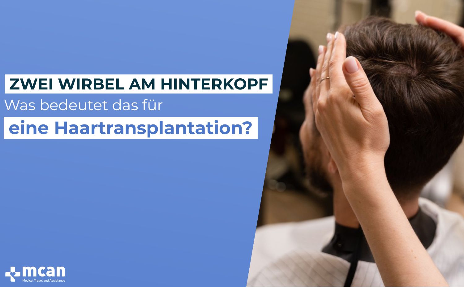 Was bedeutet das fur eine Haartransplantation